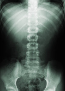 spine_2