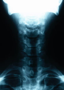 upper_spine
